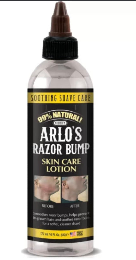 ARLO'S RAZOR BUMP 6OZ (12/CS)